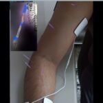 Neurophysiotherapist Jibin