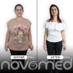 Novomed Bariatric Surgery Center – Abu Dhabi