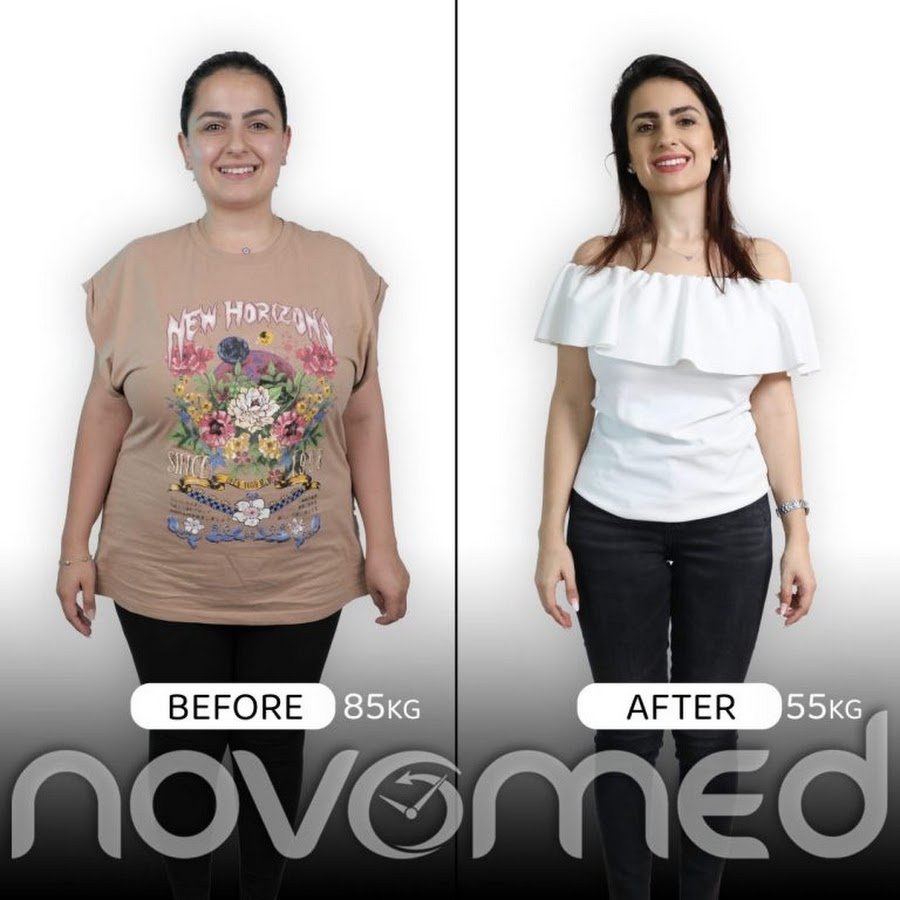 Novomed Bariatric Surgery Center – Abu Dhabi