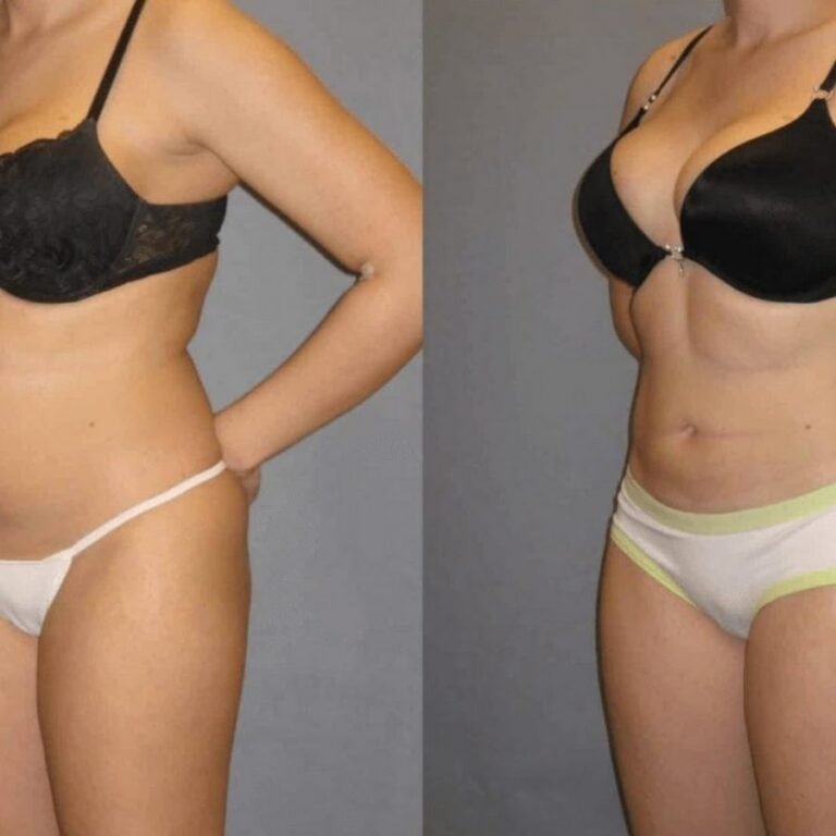 Novomed Liposuction Center – Abu Dhabi