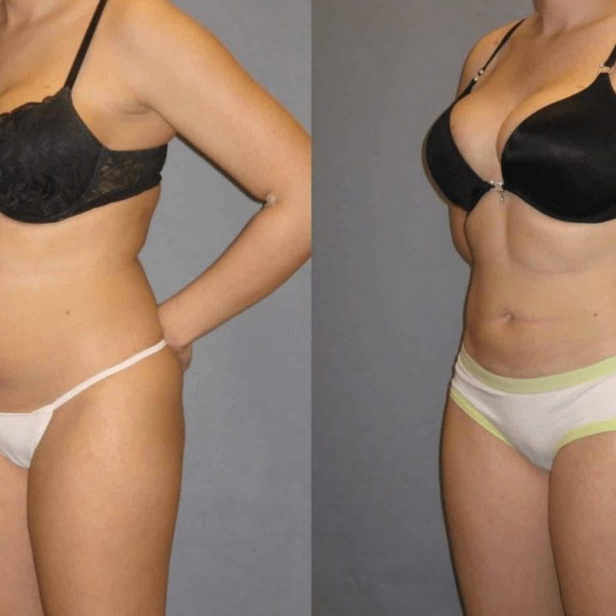 Novomed Liposuction Center – Abu Dhabi