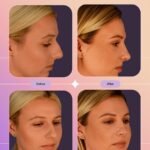Novomed Rhinoplasty Center – Abu Dhabi