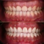 Oral Surgeon Dr. Mayyas Joudi – Dental Implantology and Periodontology