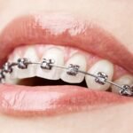 Orthodontist Al Ain Dr Diwakar Raju