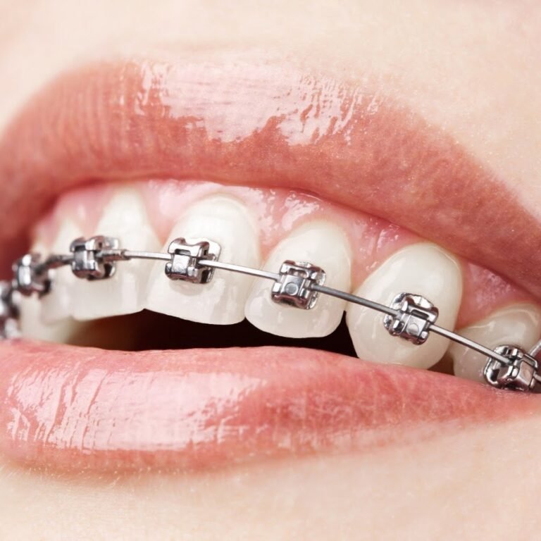 Orthodontist Al Ain Dr Diwakar Raju