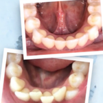 Proalign Smile Shop Dental Clinic