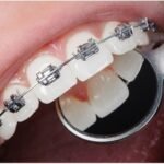 Sharjah Orthodontist -Dentist