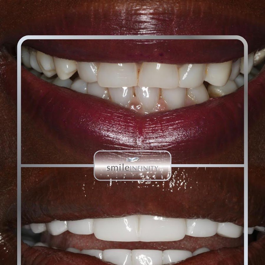 Smile Infinity Dubai