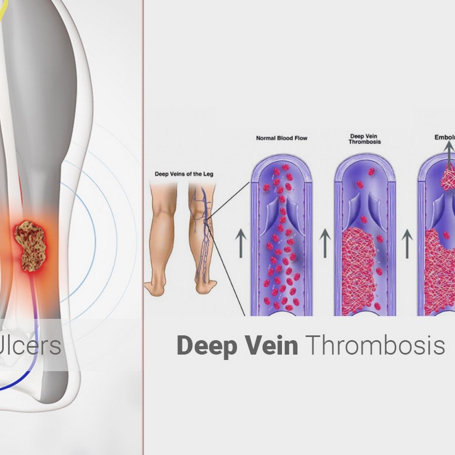 Vein Clinic