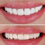 Whitey Smile Orthodontics and Implants Dental Center – Ras Al-Khaimah