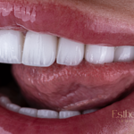 LA MAISON DES SOURIRES DENTAL CLINIC L.L.C – AL BARSHA FIRST