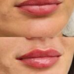 Dr. Mulham Halabi Clinic – Aesthetics & Anti Aging