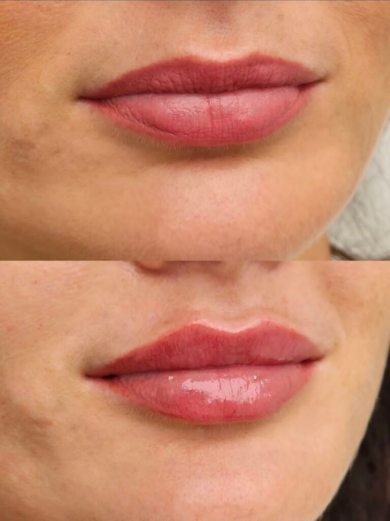 Dr. Mulham Halabi Clinic – Aesthetics & Anti Aging