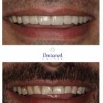 Dentamed Clinic Dubai