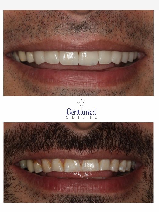 Dentamed Clinic Dubai